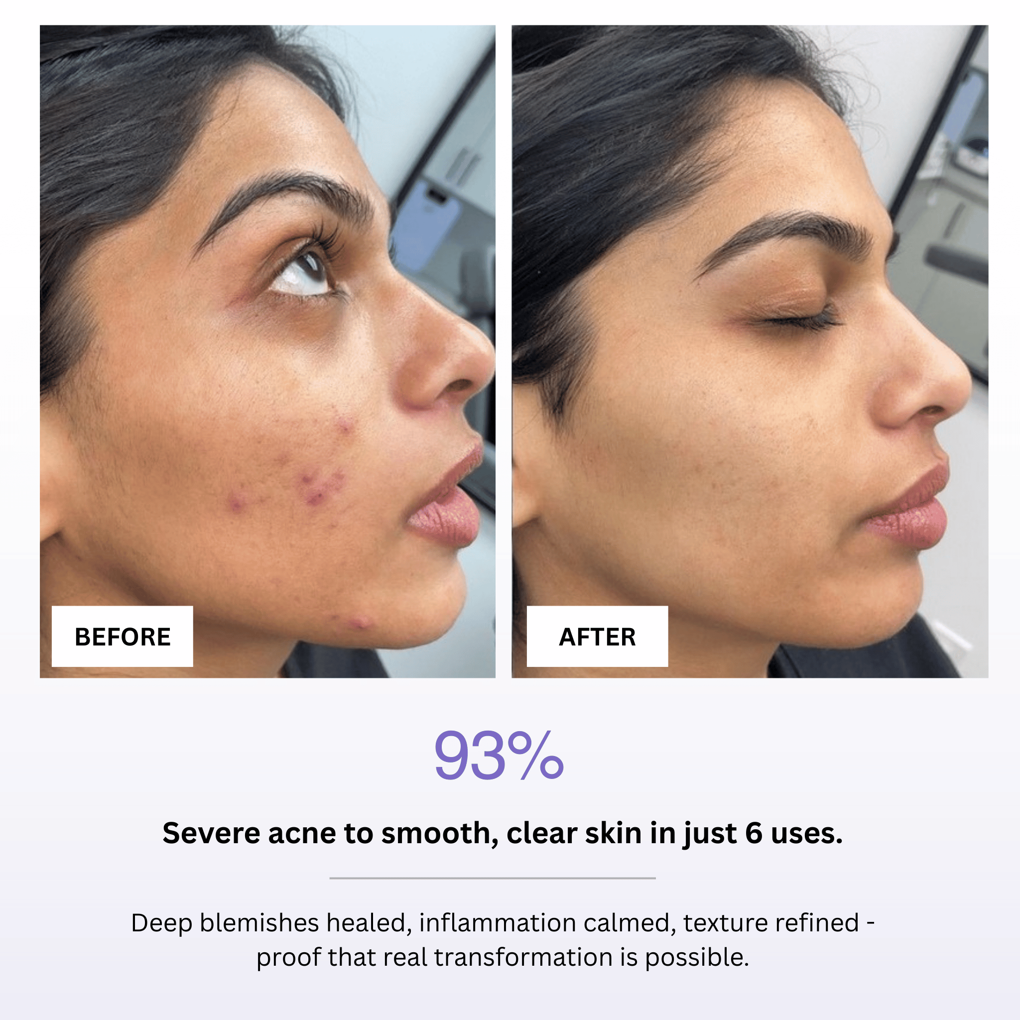 GlowLift Ice Facial Bowl
